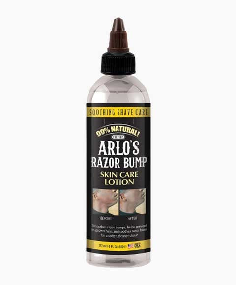 RAZOR BUMP SKIN CARE LOTION 177 ml Shaving Asetena Pa